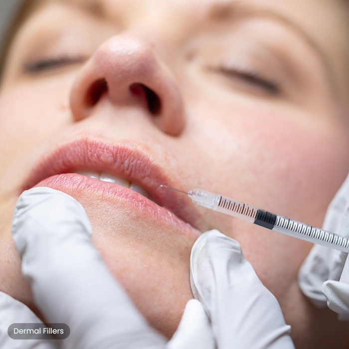 Dermal Fillers Treatment in Horsham by Amanda's Aesthetics for Facial Rejuvenation